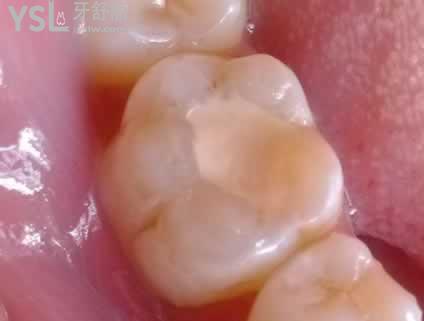 0824ab18972bd407ab6da4a97a899e510fb3093f.jpg
