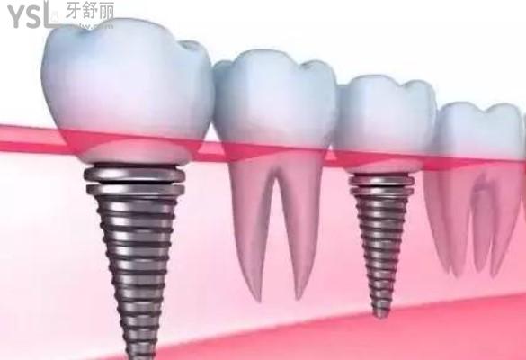 登騰.jpg