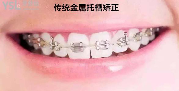 u=3665741128,3359815825&fm=26&gp=0.jpg