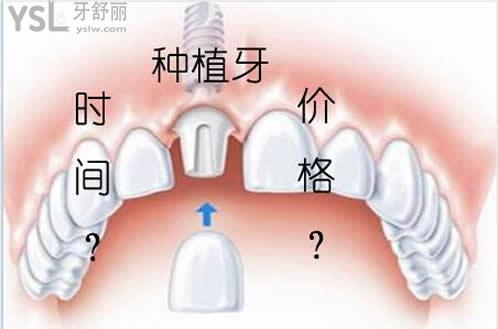 天津美奧口腔種植牙價格