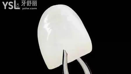牙齒貼面