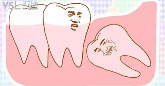 杭州美奧口腔拔牙