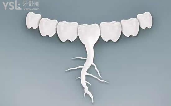 種植牙三顆疼嗎？