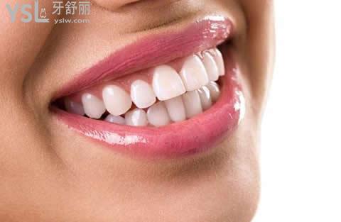 種植牙的系統(tǒng)有哪些？