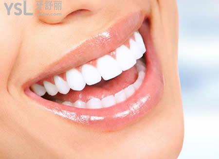 各類牙套的優(yōu)缺點(diǎn)你知道嗎？