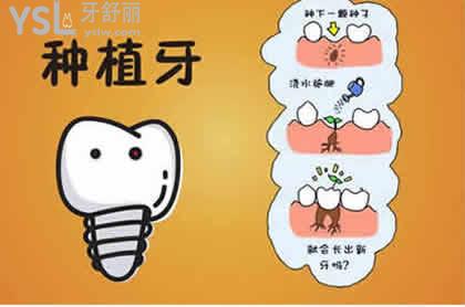 韓國(guó)登騰種植牙的優(yōu)勢(shì)：