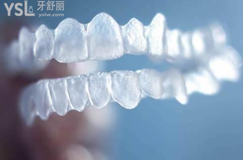 隱適美隱形矯正有年齡限制嗎？