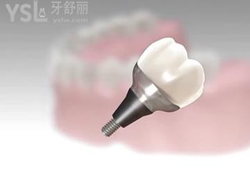 韓國登騰種植體