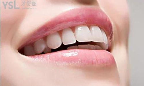 牙齒矯正