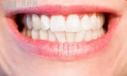 牙齒矯正