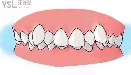 牙齒矯正