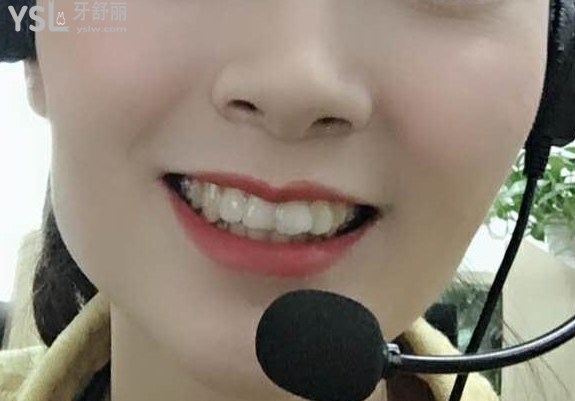 帶牙套后悔一輩子，我覺得不帶牙套才會后悔