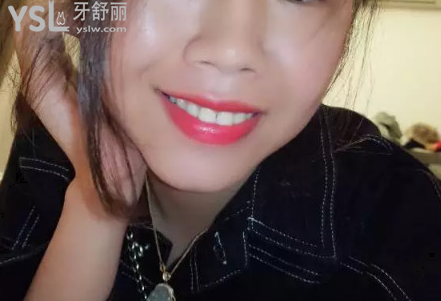 帶牙套后悔一輩子，我覺得不帶牙套才會后悔
