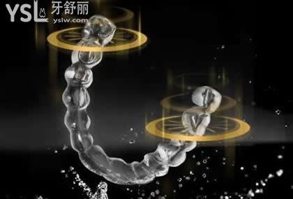 隱適美和時(shí)代天使隱形矯正如何選擇？
