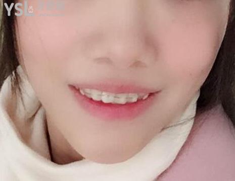 卡卡截圖_2020-06-22 02_02_21.346.png