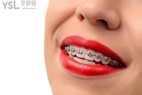 正畸牙齒