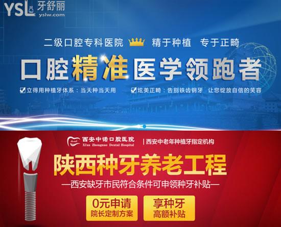 西安中諾口腔醫(yī)院口碑項目