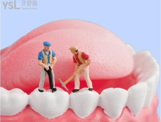 廈門峰煜口腔特色種植牙技術(shù)