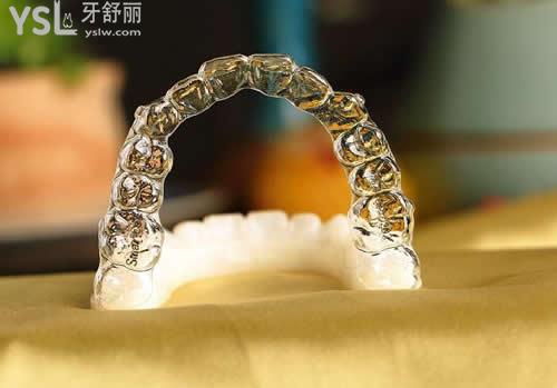 佩戴正雅隱形矯正期間的復診問題？