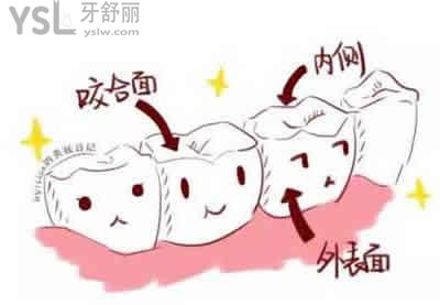 冷光美白牙齒后的護理事項？