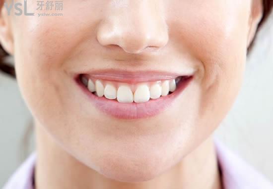 隱適美隱形矯正優(yōu)點(diǎn)：