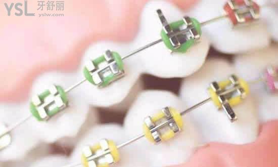 牙齒正畸