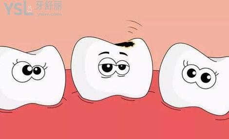 為什全瓷牙這么貴？