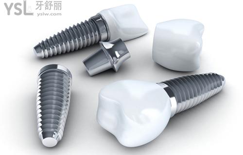 德國(guó)ICX種植體材料特點(diǎn)