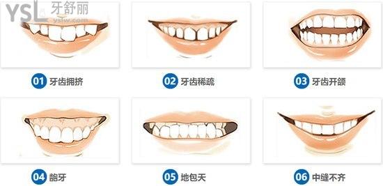 武漢清華陽光口腔美學(xué)矯正