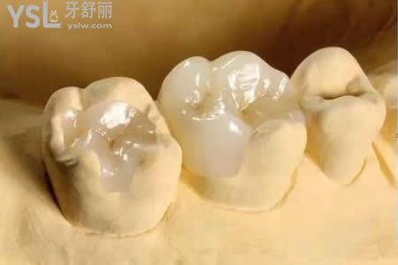 樹脂補牙后需要注意什么？