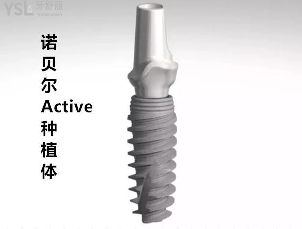 諾貝爾Active種植體