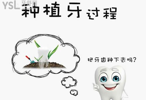 種植牙應該如何選擇種植體？