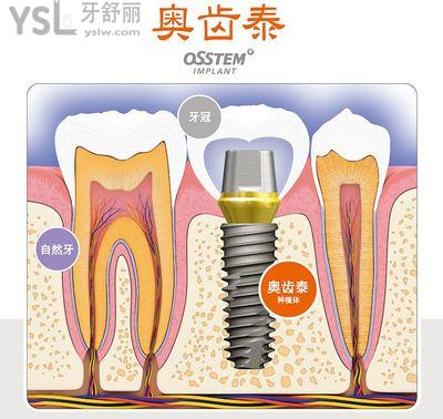 奧齒泰.jpg