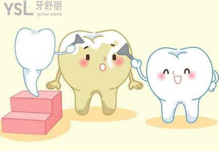 冷光美白可以維持多久？