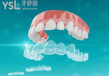 時(shí)代天使COMFOS：