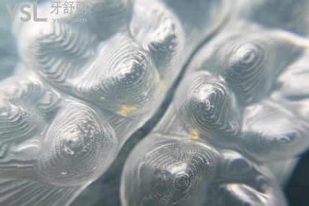 COMFOS和時(shí)代天使隱形矯正有啥區(qū)別？