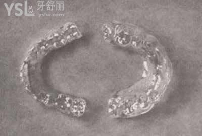 正雅隱形矯正的費用：
