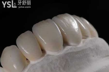 全瓷牙的優(yōu)點(diǎn)？