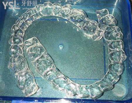 時代天使隱形矯正的優(yōu)勢：