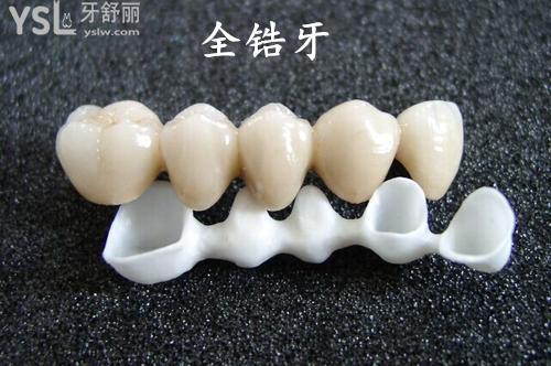 全鋯牙