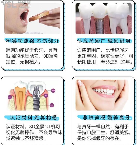 廣州穗江口腔種植牙優(yōu)勢