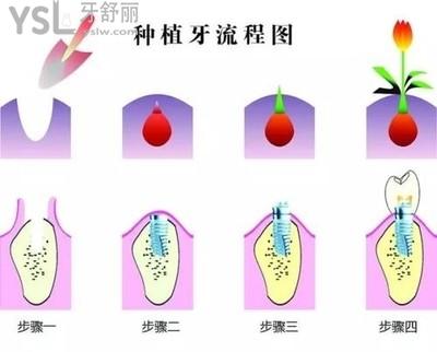 u=364774897,315166436&fm=26&gp=0.jpg