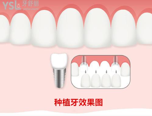 u=1267769288,4020518674&fm=26&gp=0.jpg