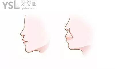 u=1036541497,2978713274&fm=26&gp=0.jpg
