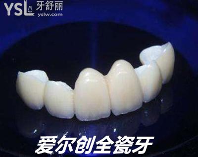 愛爾創(chuàng)全瓷牙
