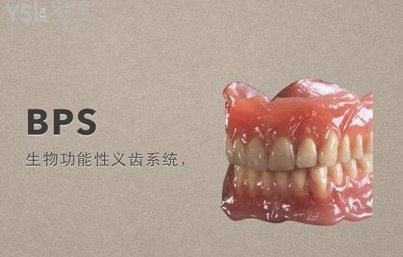 bps吸附性義齒