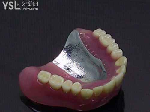 普通義齒