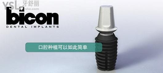 歐美種植體