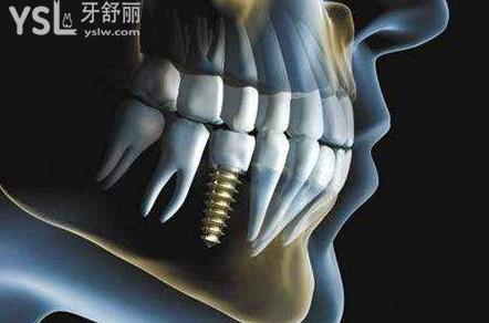 Dingtalk_20201126171529.jpg
