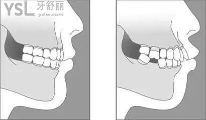 u=1837050046,163756944&fm=26&gp=0.jpg